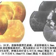 醫(yī)療利器 認識與使用敷貼器